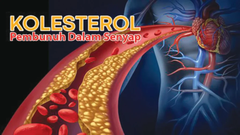 cara turunkan kolesterol bacaan kolestrol normal